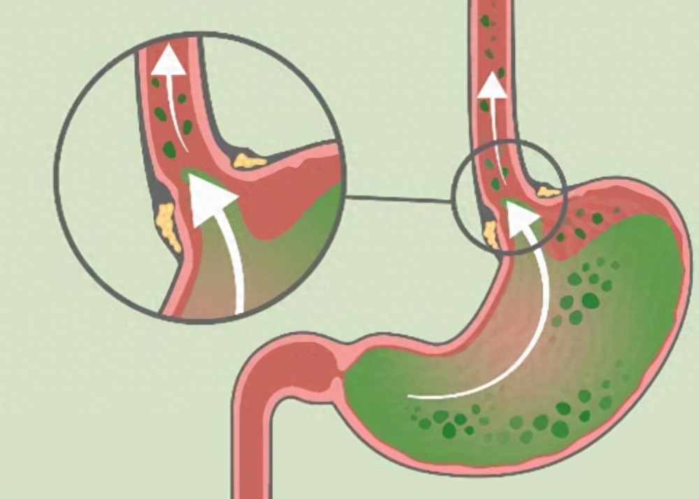 几个有效的方法，让你远离流感的困扰，一起看看如何预防感冒？(图4)