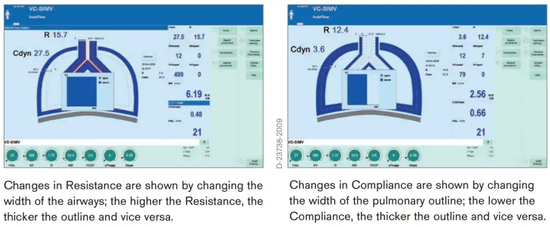 肺保护不得不了解的呼吸力学知识：说说如何吹爆一个气球(图1)