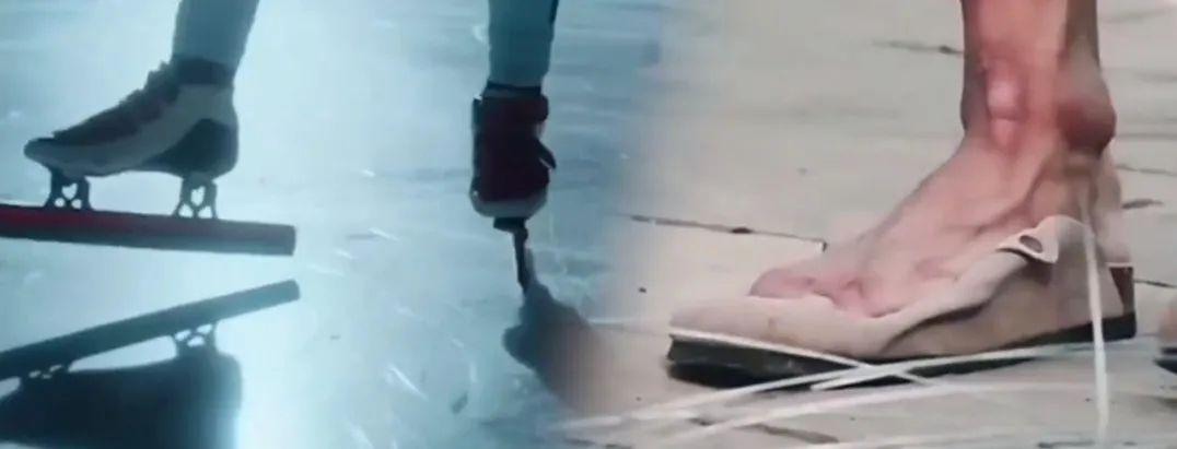 这张X光片刷屏！网友：破大防了......(图7)