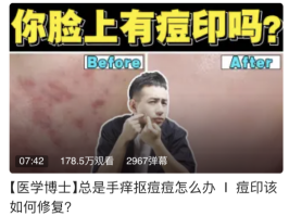 被骂到「退网」后，他又回来了(图28)