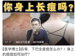 被骂到「退网」后，他又回来了(图30)