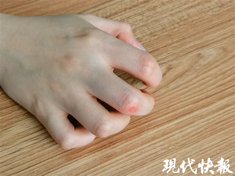 进封控区上门做核酸，这位“大白”戴手套手指还敲破皮……(图3)